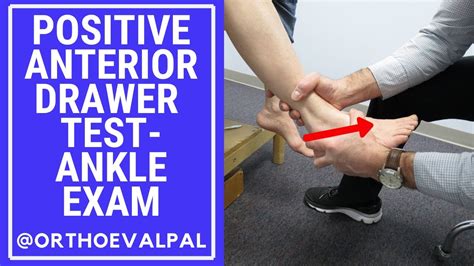 compression test ankle|positive drawer test ankle.